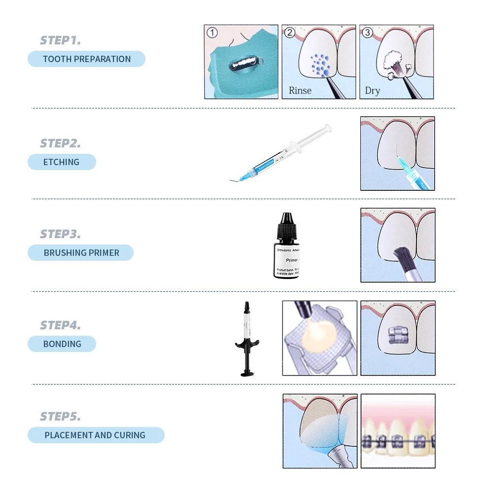Стоматологический ортодонтический клей светильник комплекте