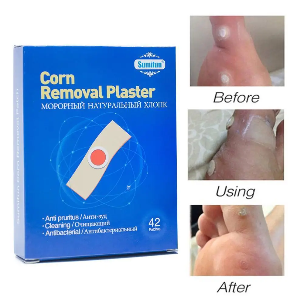 

42Pcs/Box Foot Care Sticker Medical Patch Removal Pads Warts Thorn Curative Patches Calluses Remove Callosity Detox Product
