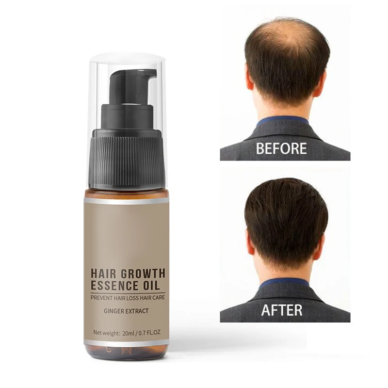 Эссенция для быстрого роста волос масло против выпадения помогает росту уход за