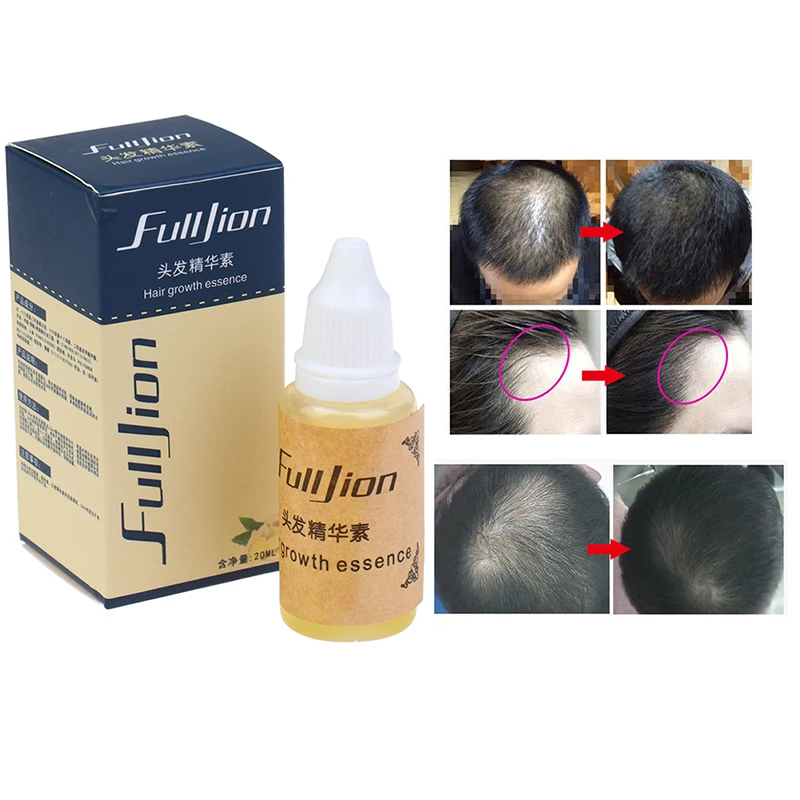 

Быстродействующая жидкая эссенция для роста волос, 20 мл, густая и длинная питательная сыворотка для роста волос, масло для истончения, выпад...