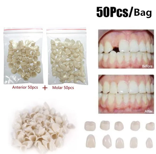 2 упаковки стоматологических материалов смешанные временные виниры в форме
