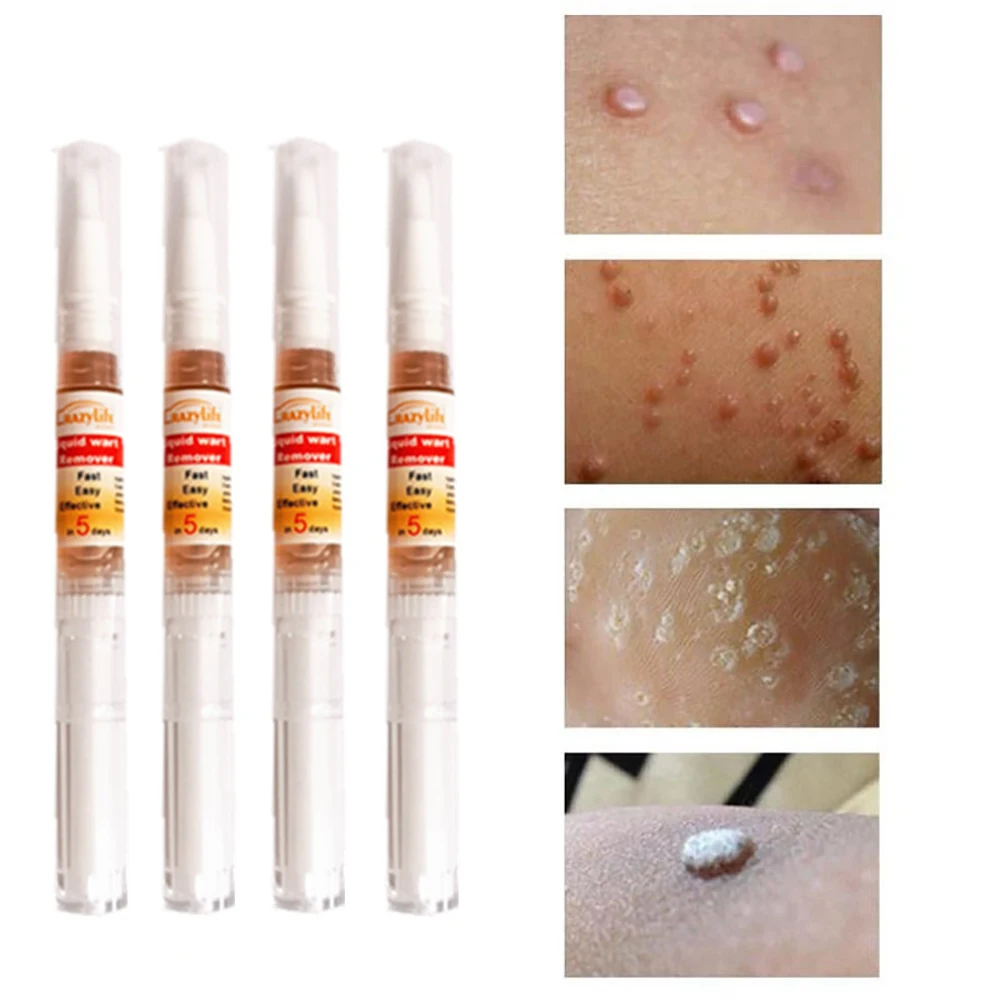 Этикетка на кожу 12 часов ручка для быстрого удаления Кротов и искусственных