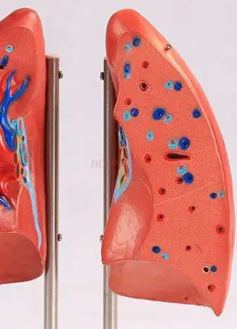 Легких модель медицинского слуховые аппараты Легочное Дыхание легких