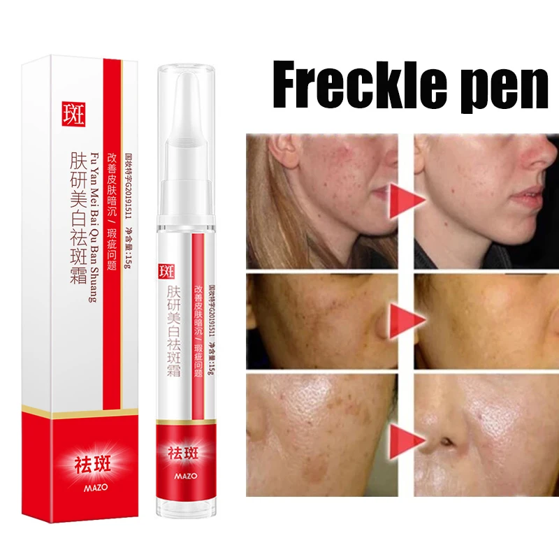 

15g Blemish Removal Gel Whitening Anti Freckle Cream Pen Effective Remove The Freckle Pigmented Melanin Spots