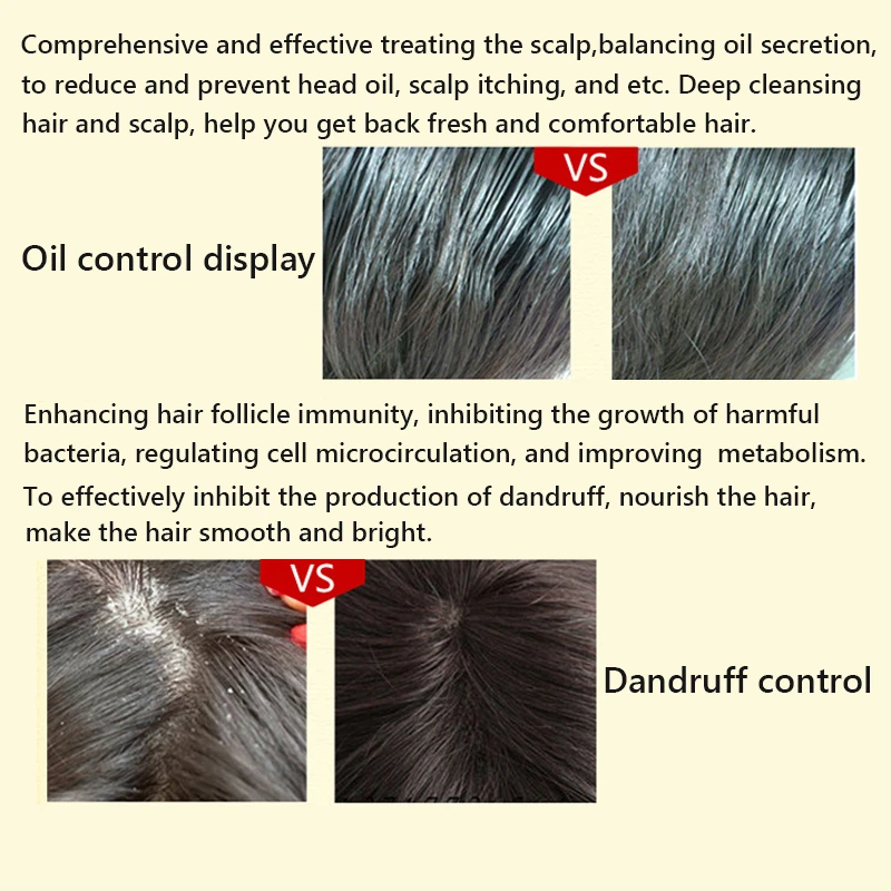 Имбирь против выпадения волос шампунь лечение способствует росту сильные корни