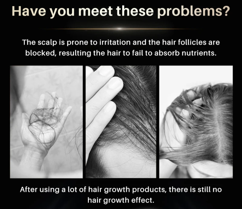 Lanthome Сыворотка для волос с черным рисом-Съемная масло против выпадения уход за