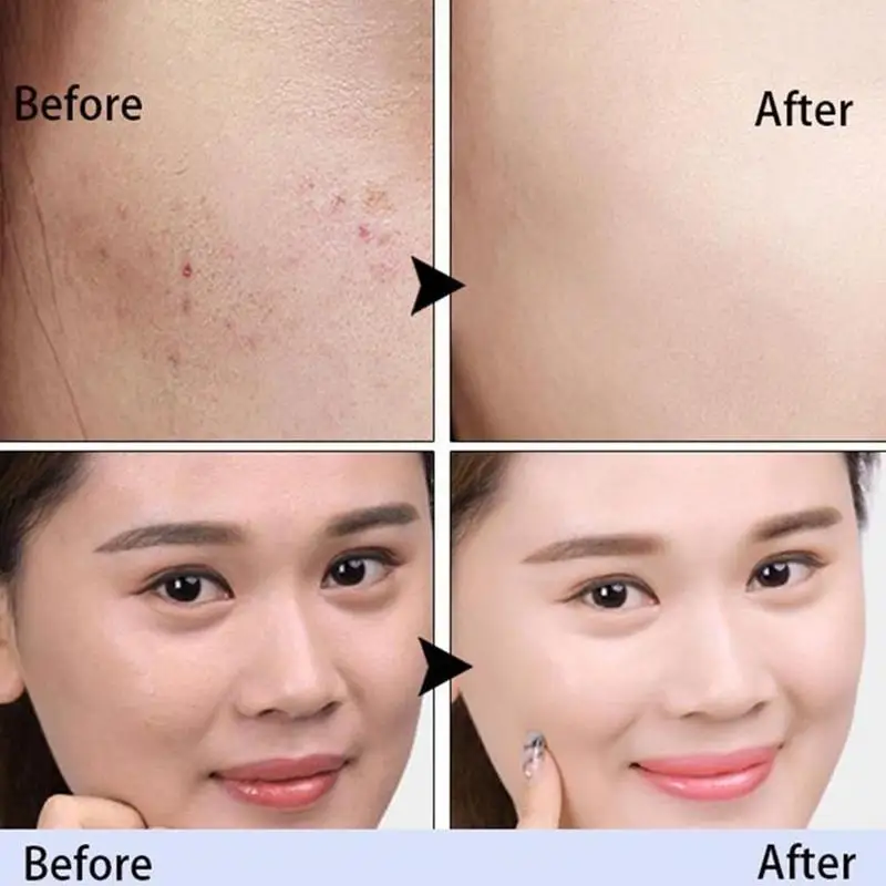 Увлажняющий BB-крем маскирующий тональный крем с губкой и кисточкой 20 г - купить по