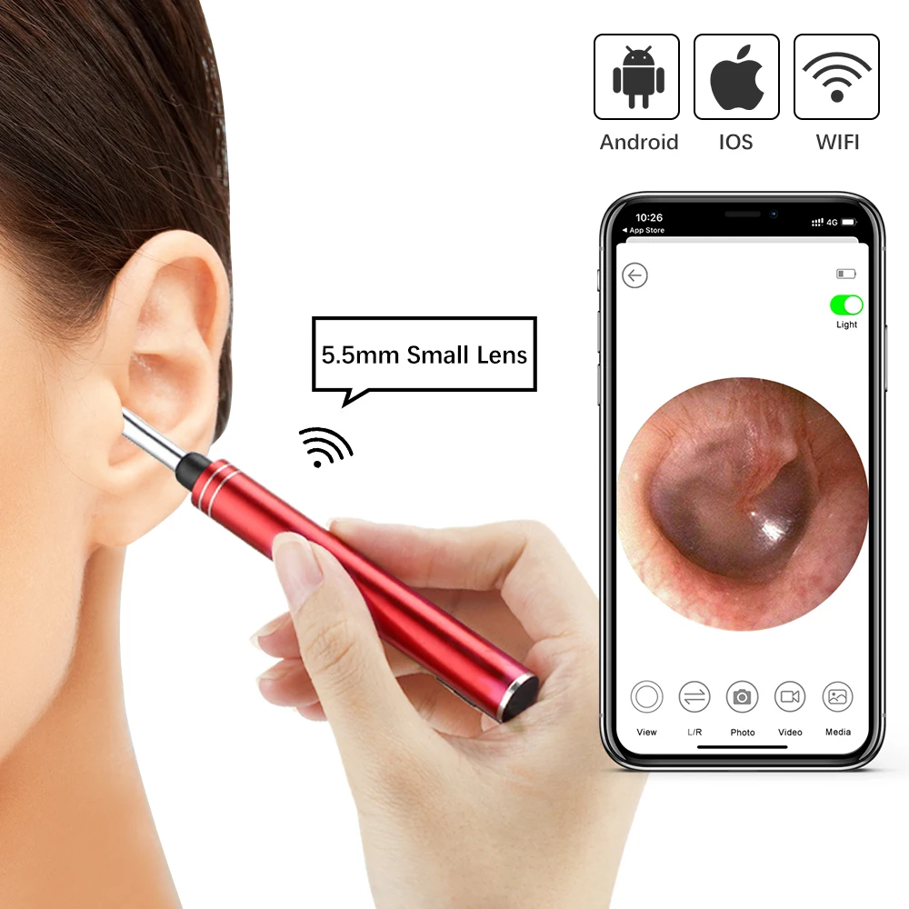 

Wireless WiFi Ear Cleaner High Precision Visual Earpick Otoscope Ear Wax Removal With Camera Teeth Oral Inspection Health Care