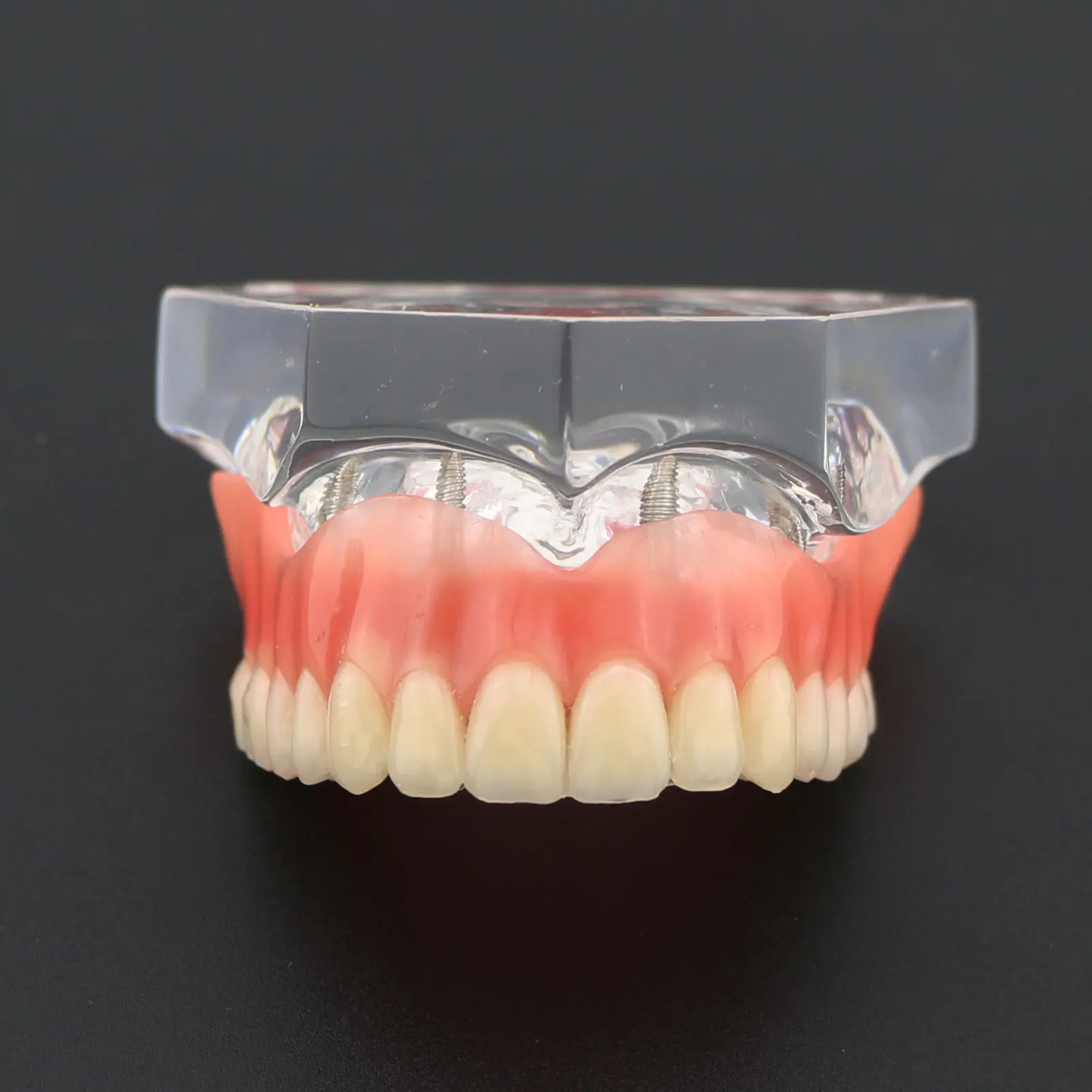 полносъемный протез акрил. полные акриловые протезы. полные акриловые протезы. частичный съемный пластиночный протез на верхнюю челюсть. полносъемный протез акрил.