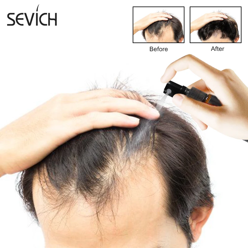 Sevich Natural Organic Plant Hair Growth Essence Oil Hair Loss Treatment Hair Oil for Fast Hair Growth Spray 1pcs Men and Women images - 6