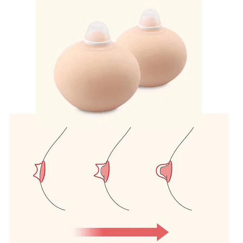 1 пара ниппель аспиратор Съемник Niplette обработки возмещения сосать формирователь
