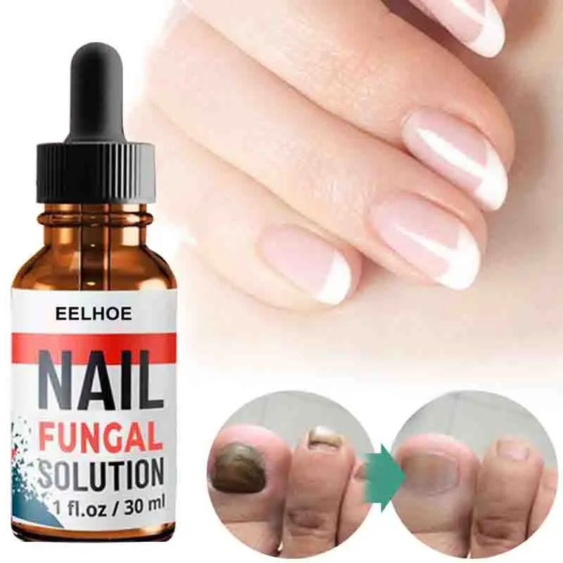 Сыворотка для восстановления ногтей сыворотка лечения грибков онихомикоз