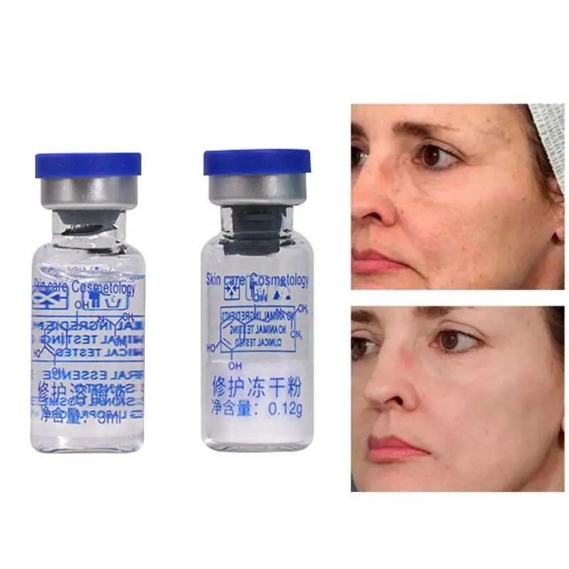 Oligopeptide               Acne