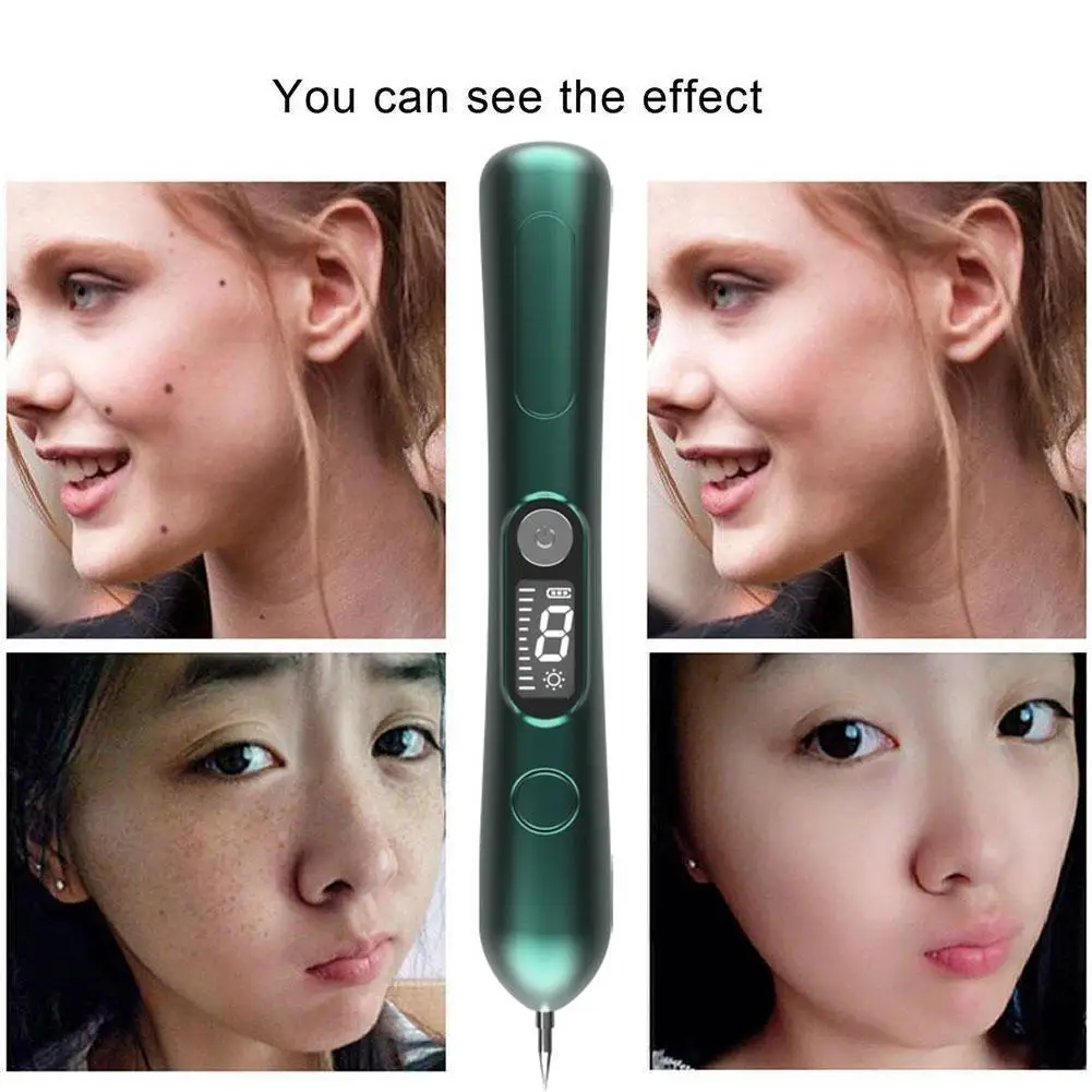 

Blue Point Mole Pen With Data Cable Skin Tag Removal Freckles Spot Men Tattoo Remover Women Wart Multifunction Beauty Tool P8V6
