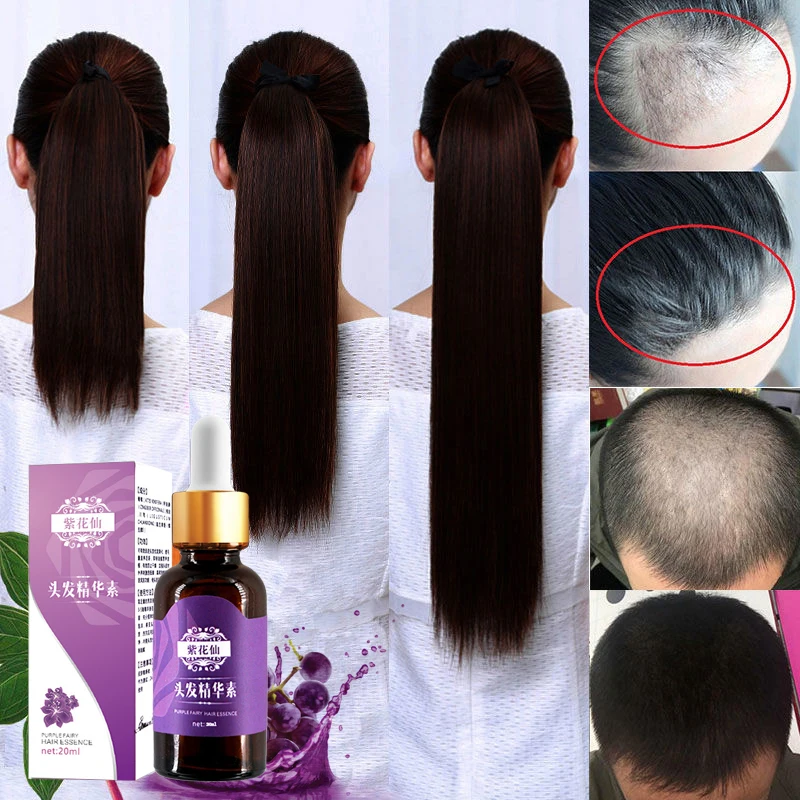 

5pcs/lot Dry and Damaged Hairs Nutrition Hair Treatment Oil For Hair Fast Hair Growth Essence Hairdressing Essential Oil