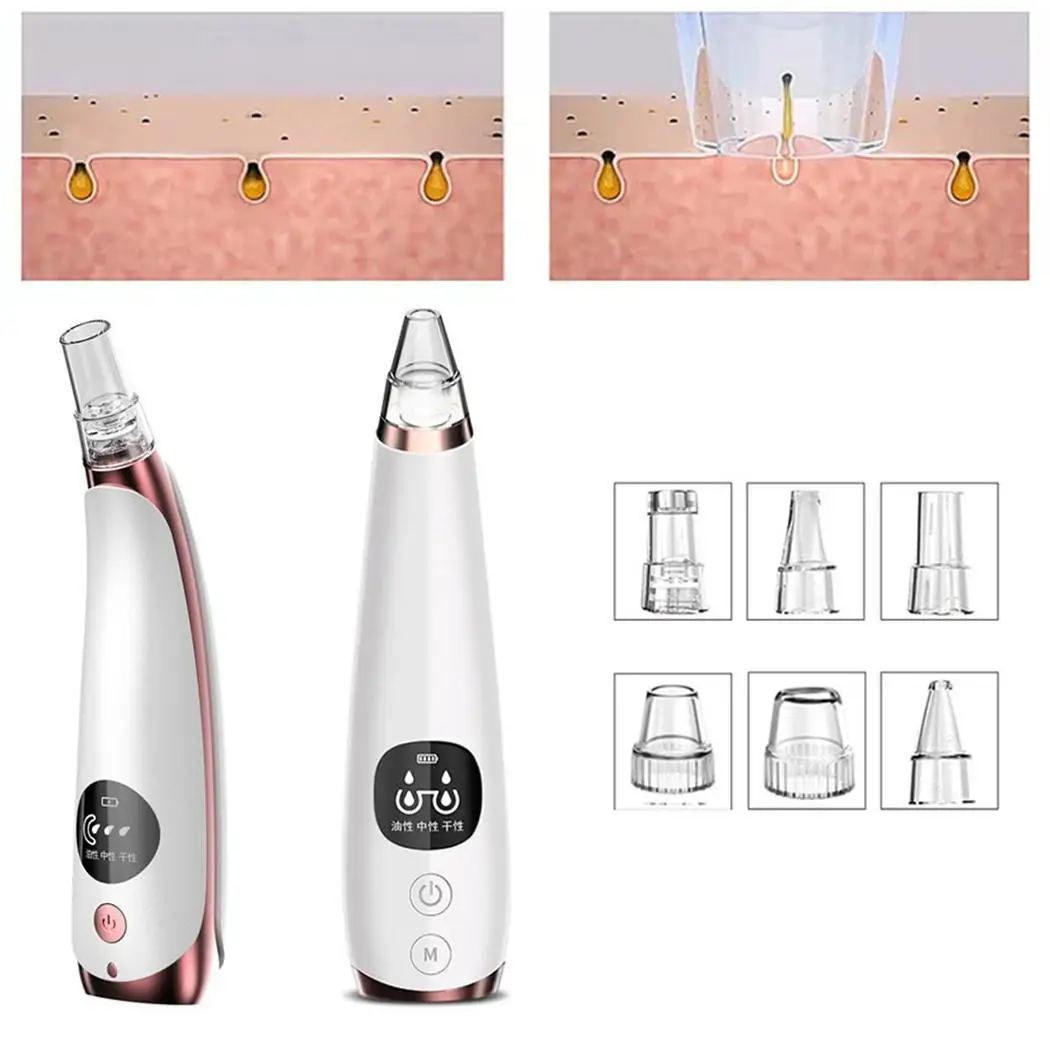 Женский электрический прибор для удаления черных точек с присоской черный 150 мин