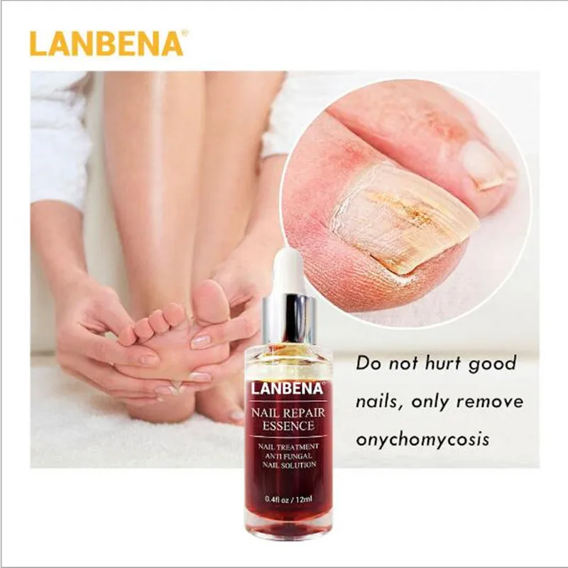 LANBENA Масло для кутикулы питательное Лечение грибка ногтей Onychomycosis Remendy Сыворотка