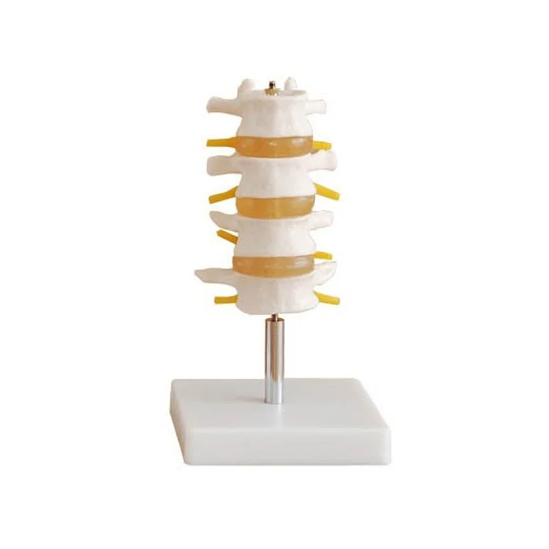 

Normal Lumbar Spine Model (four Sections) Human Body Parts Toys