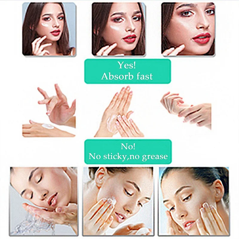 Новое поступление отбеливающий крем для лица удаляет веснушки пятна от акне