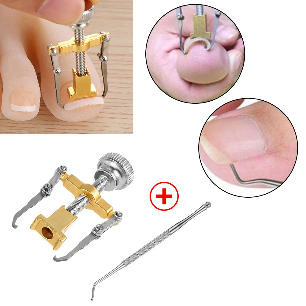 1PC Gold/Silver Stainless Steel Ingrown Toenail Correction Toes Nail Cuticle Pusher Anti Paronychia Foot Care Pedicure Tools Set | Красота и