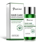 Имбирные эфирные масла для роста волос, стимулирующие восстановление волос, эссенция для предотвращения облысения, выпадения волос, сыворотка для восстановления волос