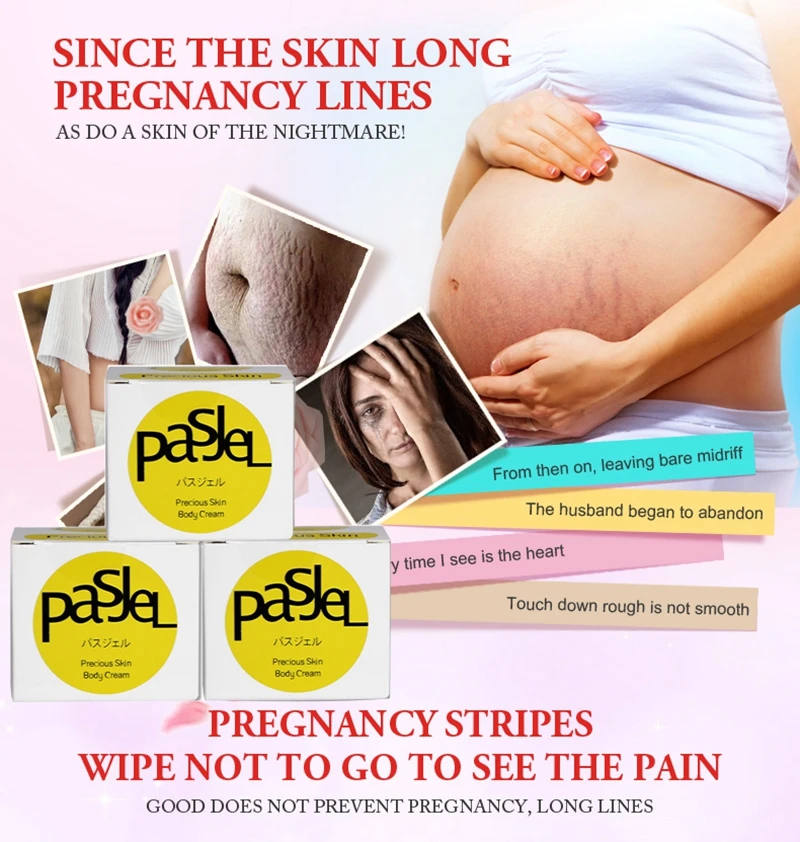 Pasjel new Arrival Effective AIVOYE stretch marks scar removal Cream slack line firming &amp lifting skin mark repair cream | Красота и