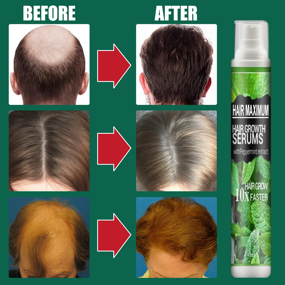 3/1pcs Herbal Essence Hair Growth Spray Serum Anti Loss Products Fast Grow Prevent Dry Damaged Thinning Repair Care | Красота и