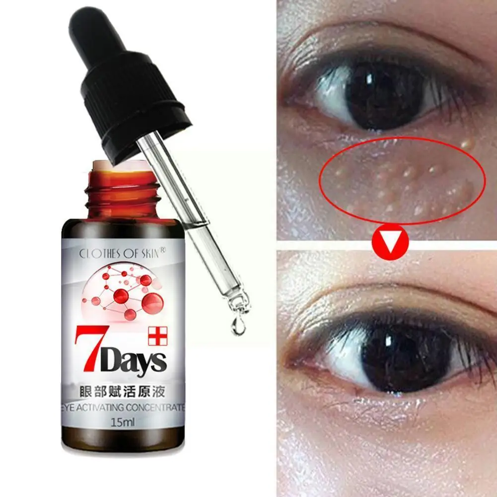 

Fatty eye cream Effective Anti-Wrinkle Whitening Skin Circles Care Fat eye cream Dark Moisturizer Anti-Puffiness Granule Re G7Y5