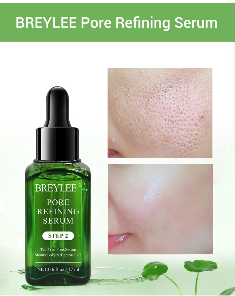 

1PC BREYLEE Acne Treatment Serum Natural Facial Essence Acne Scar Removal Face Skin Care Whitening Efficient Repairing Pore