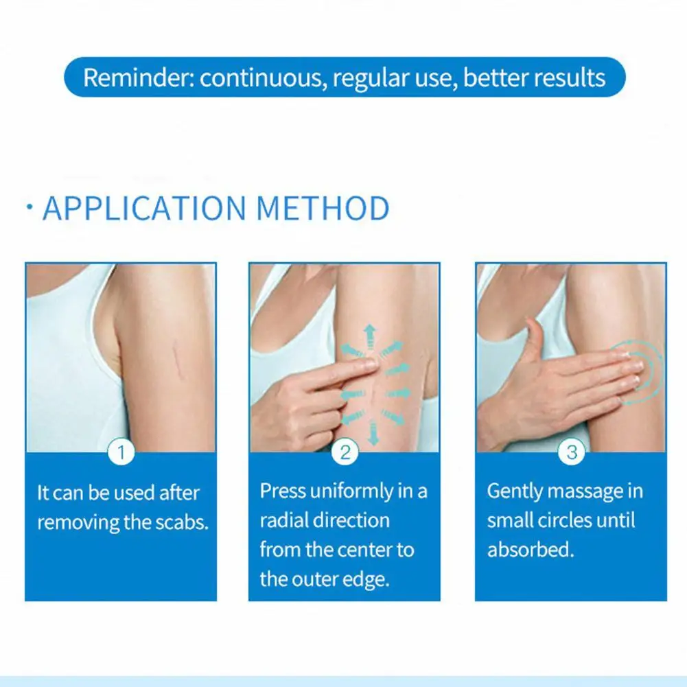 Крем для удаления шрамов от акне гель прыщи растяжки ожоги крем разглаживающий