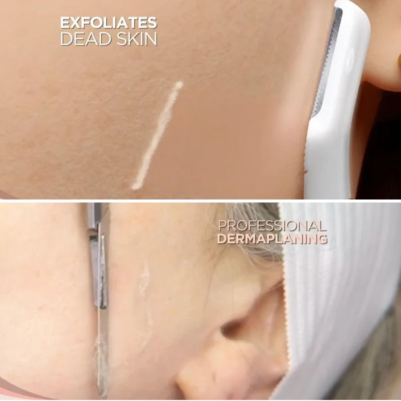 

Face Hair Remover Facial Glow Expoliator Lady Electric Light Razor Shaver Painless Expoliates Dead Skin Tool