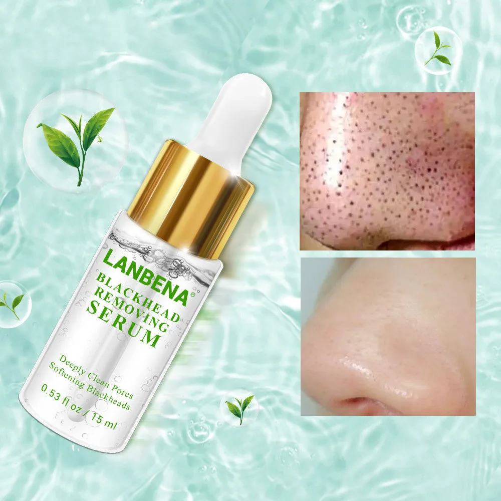 LANBENA Удаление угрей сывороточная эссенция глубокие поры акне прыщи бережное