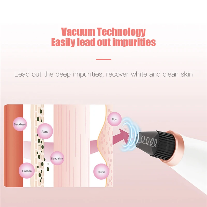 Средство для удаления угрей вакуумные угри на носу очиститель пор удаление