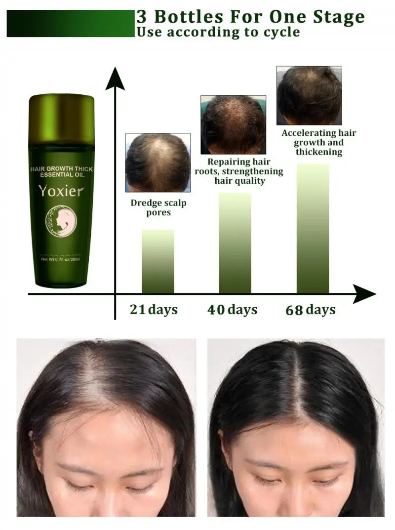 Yoxier эфирное масло для роста волос травяной шампунь уход за волосами средство от