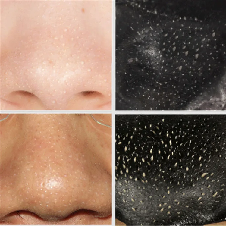 10/много красивых бровей лица черные пятна маска от акне уход за лицом полосы