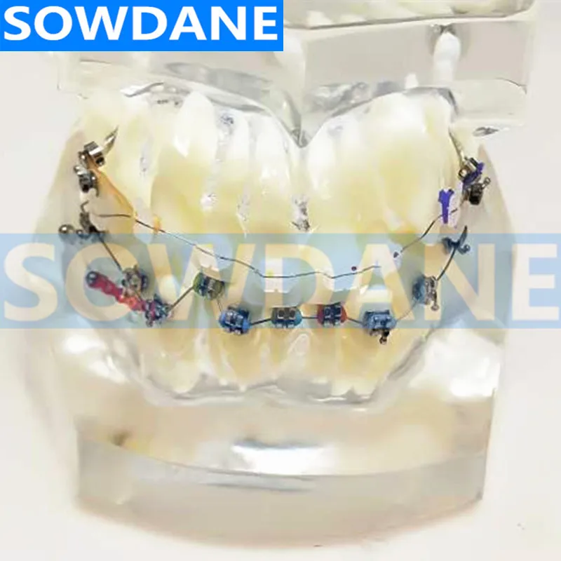 Прозрачная Стоматологическая Ортодонтическая модель для прикуса с двумя видами