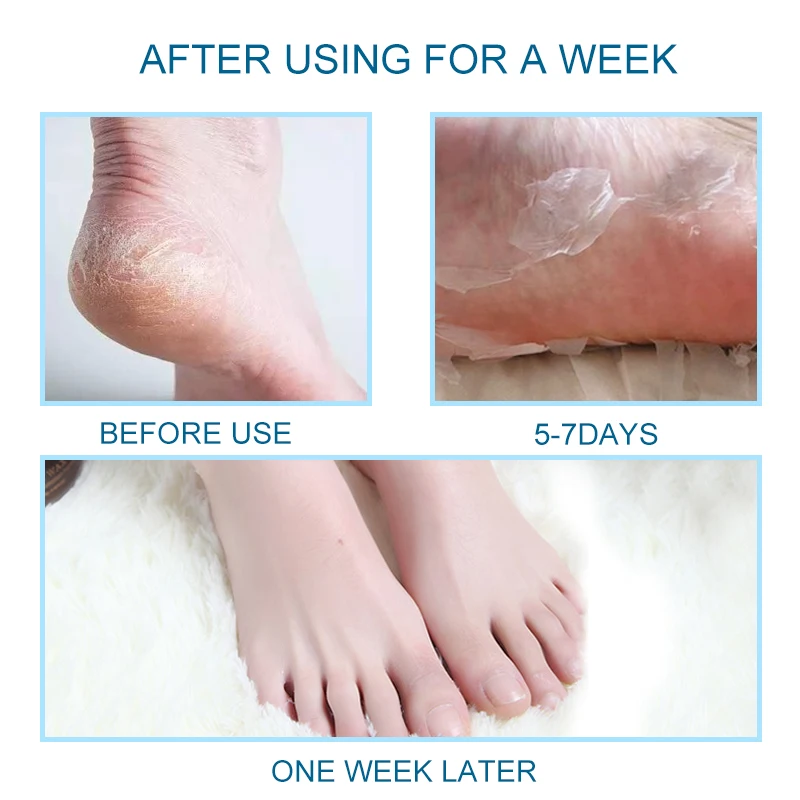 2 шт. отшелушивающая маска для ног пилинг удаление омертвевшей кожи педикюрные