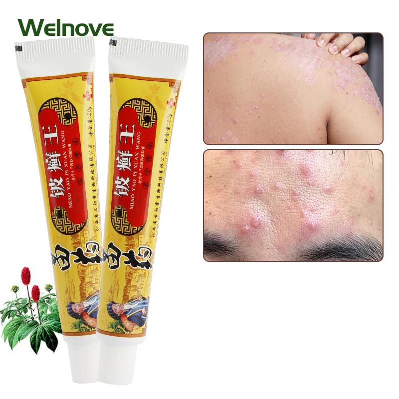 

20g Anti Itch Antibacterial Psoriasis Bedsore Ointment Eczema Dermatitis Pruritus Cream Herbal Medical Plaster Skin Care Beauty