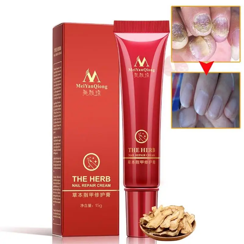 

MeiYanQiong Herbal Nail Repair Cream Treatment Onychomycosis Cream Fungal Anti Toe Fungus Infection Paronychia Nail Car Rem E0H4