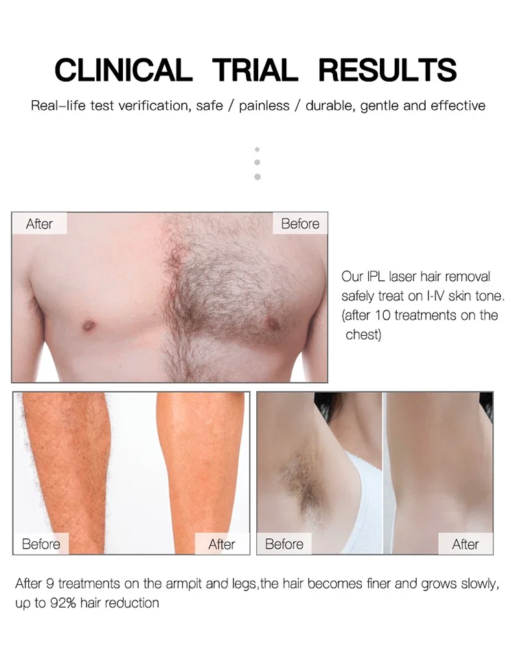 

Laser Epilator Painless IPL Hair Removal System for Women bikini Facial Body Profesional Permanent Hair Remover Device