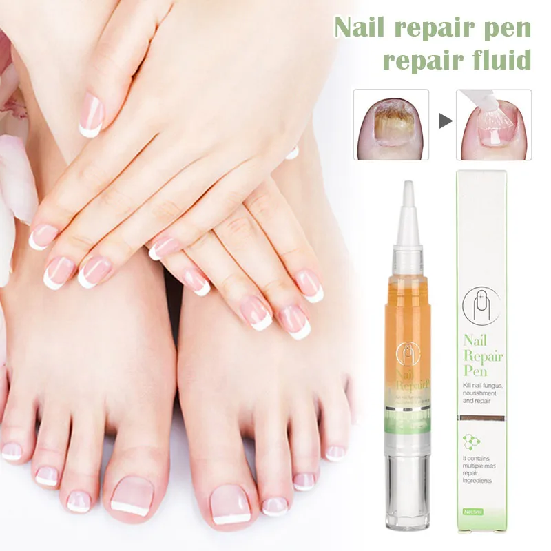 

Fingernail Toenail Repair Pen Nail Repair Pen Protect from Discoloration Brittle Crack SSwell