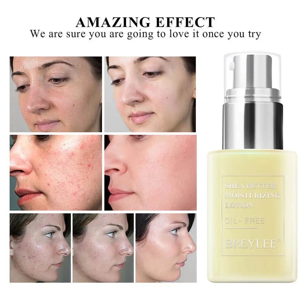 Крем для лица масло ши увлажняющий лосьон уход за кожей лечение акне эмульсия