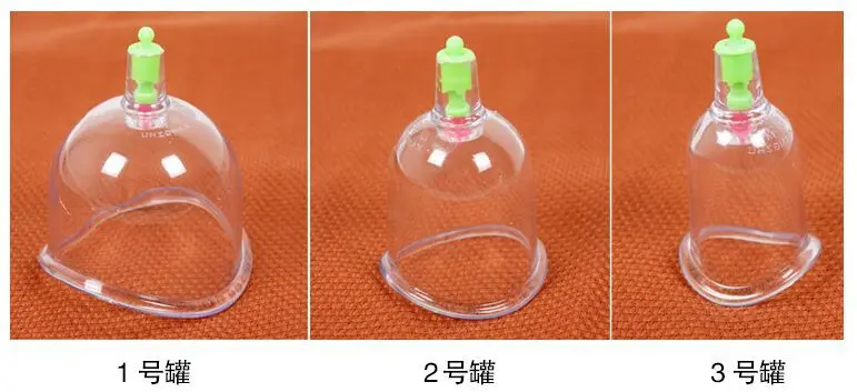 Бесплатная доставка набор изогнутых вакуумных банок с китайскими банками для