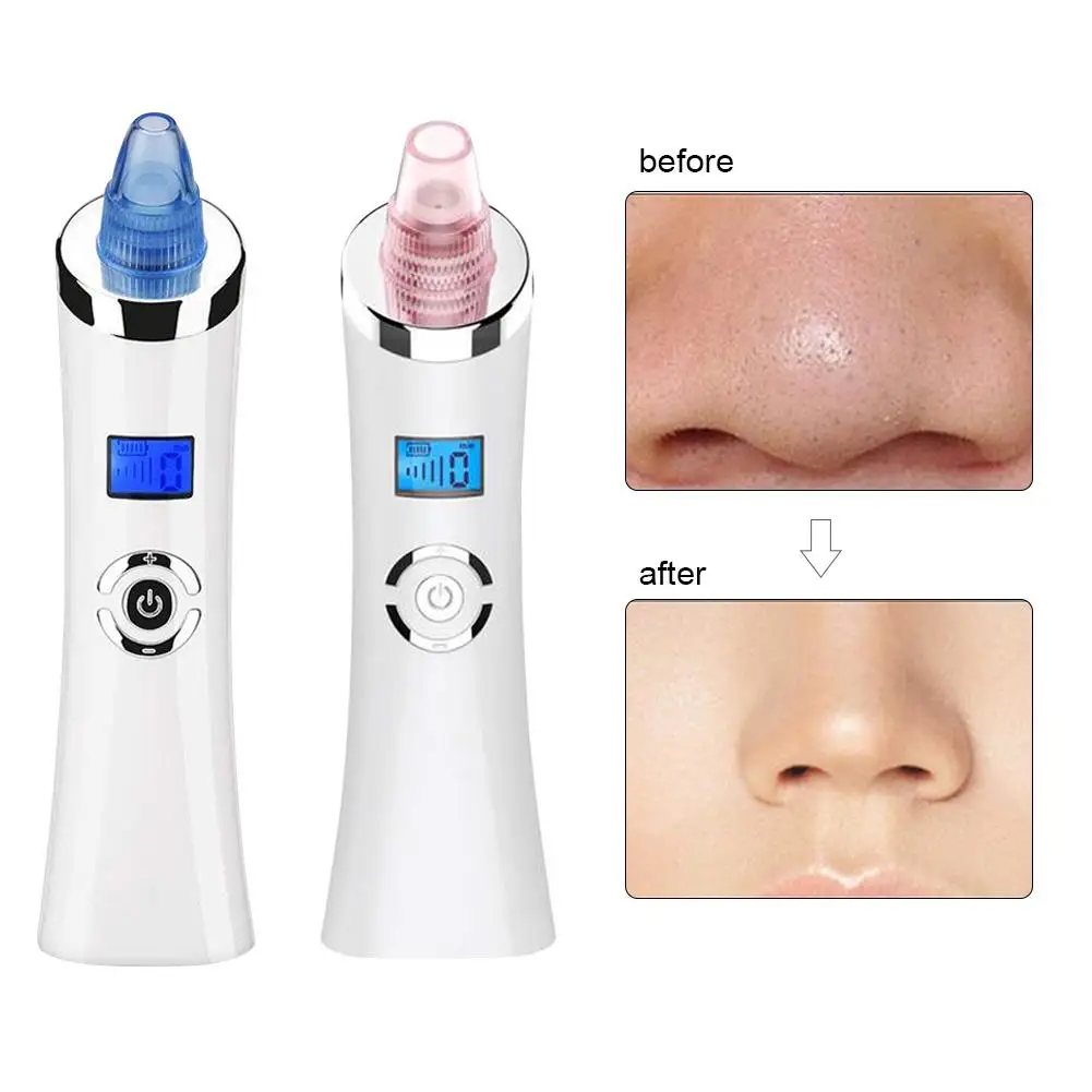 

Устройство для очистки лица, устройство для удаления черных точек, USB-зарядка, 5 уровней регулировки