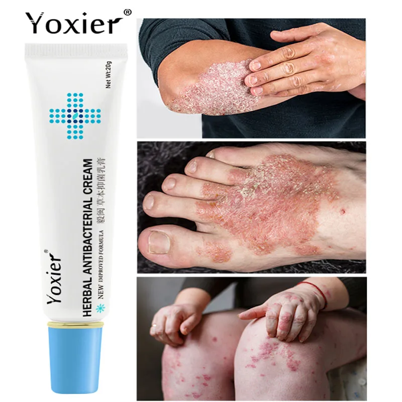 Антибактериальный крем Yoxier эффективное средство против зуда псориаз дерматит