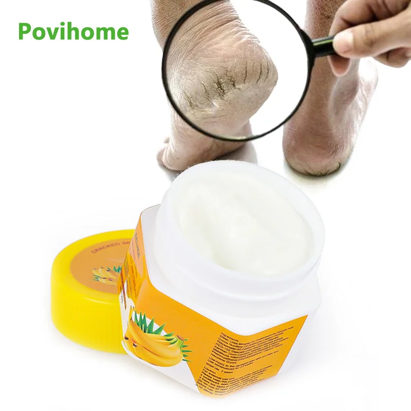 

1pcs 20g Natural Banana Oil Dead Skin Remover Fast Repair Foot Cream Skin Care Product Anti-Drying Crack Strong Effective Cream