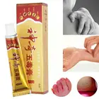 Лечение псориаза, искусственная мазь, дерматит, экзема, крем, лечение детской кожи, новинка