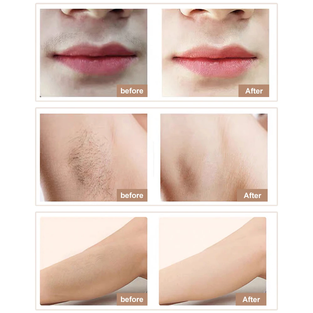 Лазерный эпилятор IPL для удаления волос Эпилятор с ЖК экраном 990000 вспышек триммер