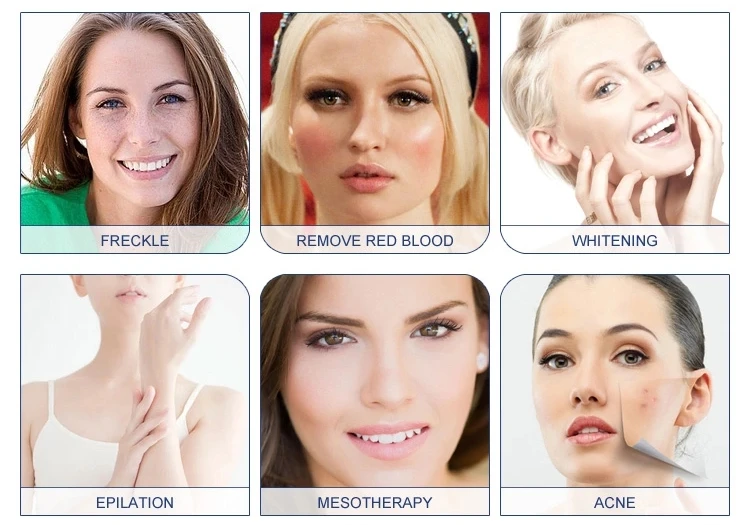 IPL/OPT/SHR/ELIGHT/beauty машина хорошая цена