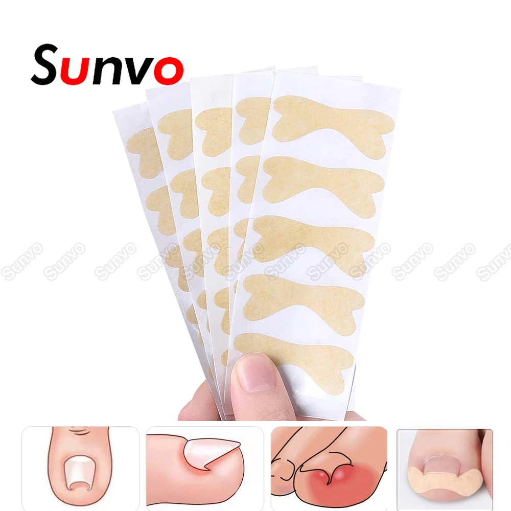 Sunvo без клея для ногтей пластырь вросших корректирующая наклейка s Paronychia